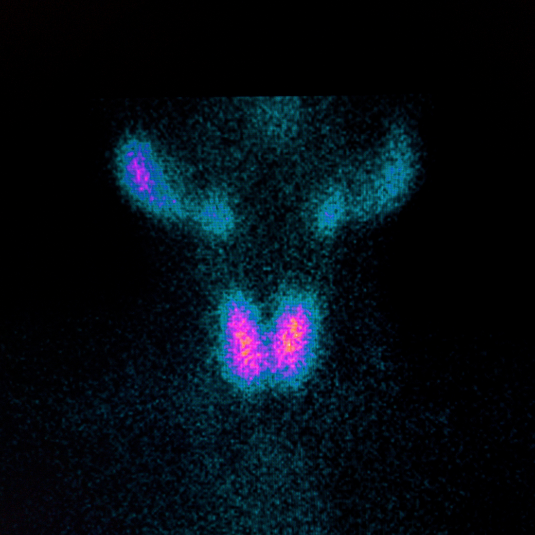 Les perturbateurs endocriniens et leurs impacts sur la fertilité