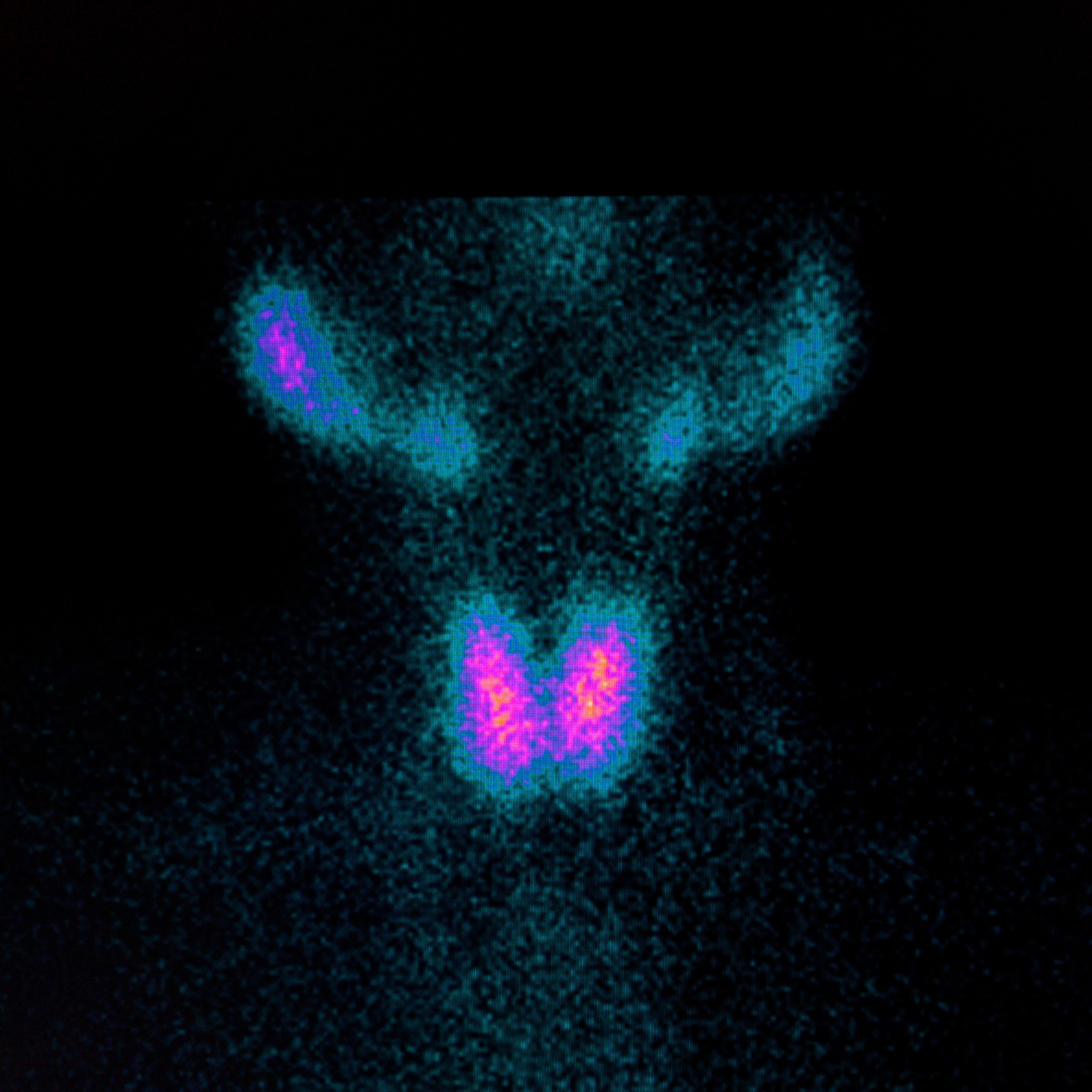 Les perturbateurs endocriniens et leurs impacts sur la fertilité