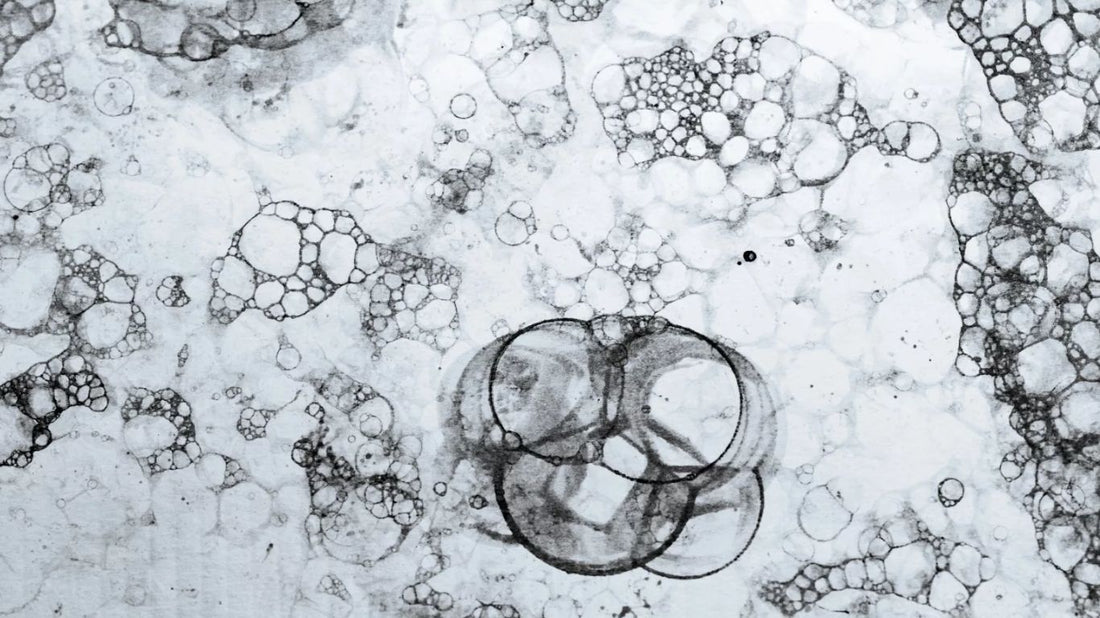 SOPK Syndrome des ovaires polykystiques